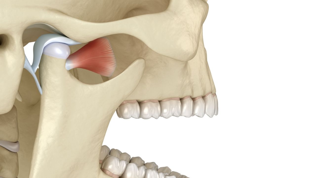 Disfunção da articulação temporomandibular (ATM).